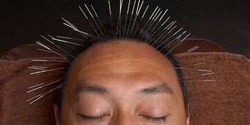 育毛鍼